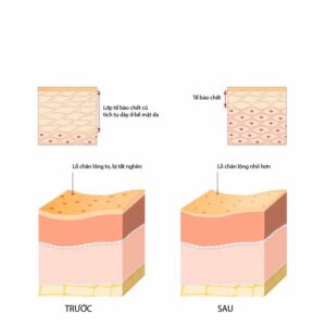 Một Vài Điều Cần Biết Về Tẩy Tế Bào Chết